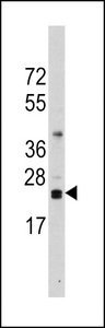 Western blot of anti-CD3Z Antibody (RB13817) in Ramos cell line lysates (35 ug/lane). CD3Z(arrow) was detected using the purified antibody.