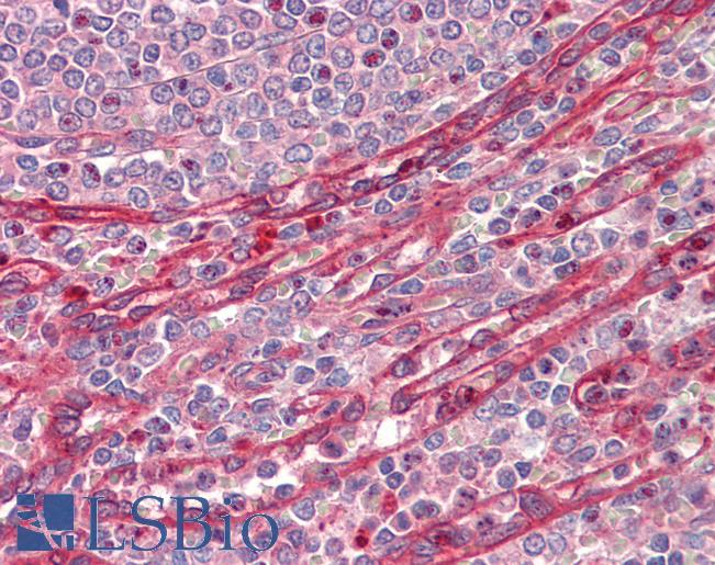 Anti-ADAM19 antibody IHC staining of human spleen. Immunohistochemistry of formalin-fixed, paraffin-embedded tissue after heat-induced antigen retrieval.
