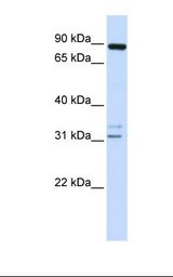721_B cell lysate. Antibody concentration: 1.0 ug/ml. Gel concentration: 12%.