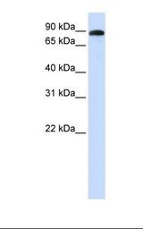 Fetal muscle lysate. Antibody concentration: 1.0 ug/ml. Gel concentration: 12%.