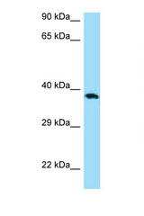 CD276 / B7-H3 antibody LS-C146560 Western blot of MCF7 Cell lysate. Antibody concentration 1 ug/ml.