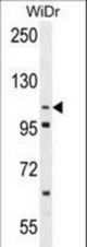 Western blot of ADAM19 Antibody in WiDr cell line lysates (35 ug/lane). ADAM19 (arrow) was detected using the purified antibody.