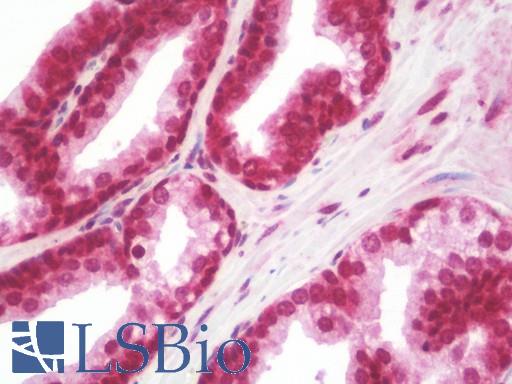 Anti-CD276 / B7-H3 antibody IHC staining of human prostate. Immunohistochemistry of formalin-fixed, paraffin-embedded tissue after heat-induced antigen retrieval.