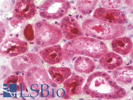 Anti-CD276 / B7-H3 antibody IHC staining of human kidney. Immunohistochemistry of formalin-fixed, paraffin-embedded tissue after heat-induced antigen retrieval. Antibody LS-B10547 dilution 1:100.
