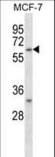 CD276 Antibody western blot of MCF-7 cell line lysates (35 ug/lane). The CD276 antibody detected the CD276 protein (arrow).