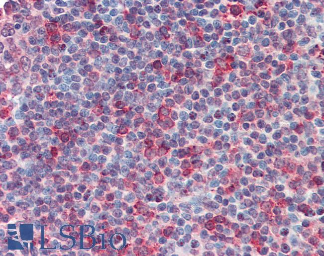 Anti-CD70 antibody LS-A8809 IHC of human tonsil.. Immunohistochemistry of formalin-fixed, paraffin-embedded tissue after heat-induced antigen retrieval.