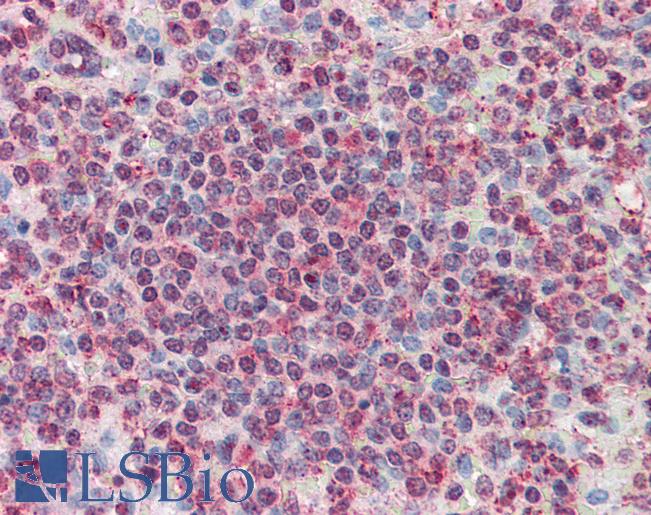 Anti-CD70 antibody LS-A8809 IHC of human spleen. Immunohistochemistry of formalin-fixed, paraffin-embedded tissue after heat-induced antigen retrieval.