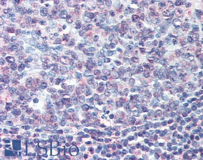 Anti-CD70 antibody LS-A8812 IHC of human tonsil. Immunohistochemistry of formalin-fixed, paraffin-embedded tissue after heat-induced antigen retrieval.