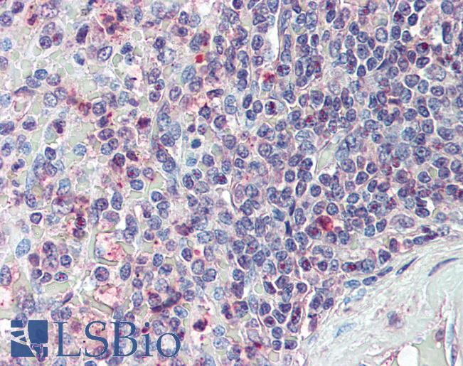 Anti-CD70 antibody LS-A8812 IHC of human spleen. Immunohistochemistry of formalin-fixed, paraffin-embedded tissue after heat-induced antigen retrieval.