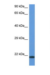 CD70 antibody LS-C145332 Western blot of ACHN Cell lysate. Antibody concentration 1 ug/ml.