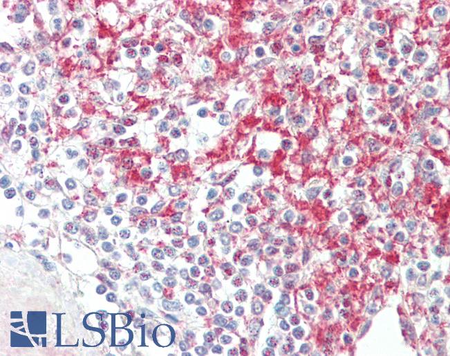 Anti-ADAM19 antibody IHC staining of human spleen. Immunohistochemistry of formalin-fixed, paraffin-embedded tissue after heat-induced antigen retrieval. Antibody LS-B10602 concentration 5 ug/ml.