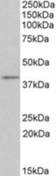 CD28 antibody (0.3 ug/ml) staining of Mouse Thymus lysate (35 ug protein/ml in RIPA buffer). Primary incubation was 1 hour. Detected by chemiluminescence.