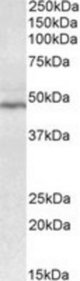 CD28 antibody (0.3 ug/ml) staining of Human Tonsil lysate (35 ug protein/ml in RIPA buffer). Primary incubation was 1 hour. Detected by chemiluminescence.