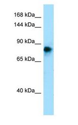 ADAM2 / Fertilin Beta antibody Western Blot of Fetal Skin.