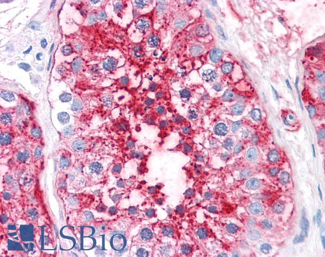 Anti-ADAM20 antibody LS-A8802 IHC of human testis. Immunohistochemistry of formalin-fixed, paraffin-embedded tissue after heat-induced antigen retrieval.