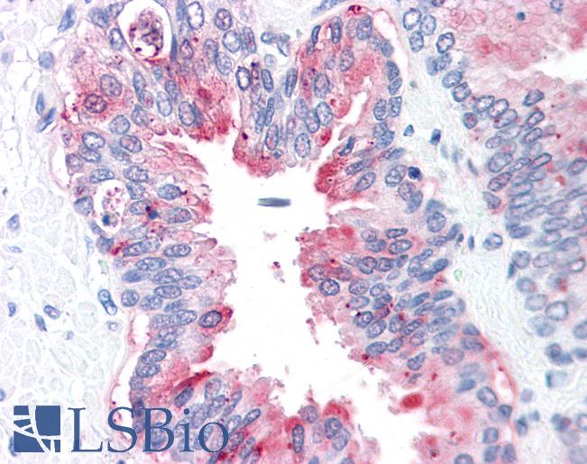 Anti-ADAM20 antibody LS-A8802 IHC of human prostate. Immunohistochemistry of formalin-fixed, paraffin-embedded tissue after heat-induced antigen retrieval.
