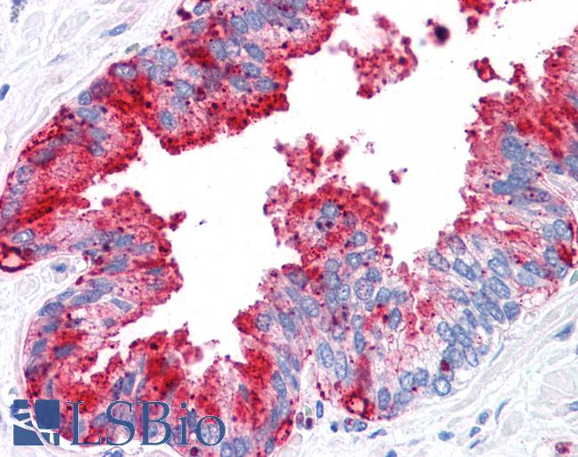 Anti-ADAM20 antibody LS-A8800 IHC of human prostate. Immunohistochemistry of formalin-fixed, paraffin-embedded tissue after heat-induced antigen retrieval.