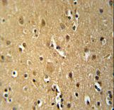 TNFRSF8-Y479 Antibody immunohistochemistry of formalin-fixed and paraffin-embedded human brain tissue followed by peroxidase-conjugated secondary antibody and DAB staining.