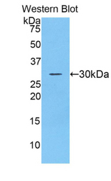 Western blot of recombinant ADAM20.