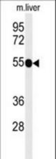 Western blot of TNFRSF8-Y479 in mouse liver tissue lysates (35 ug/lane). TNFRSF8 (arrow) was detected using the purified antibody.