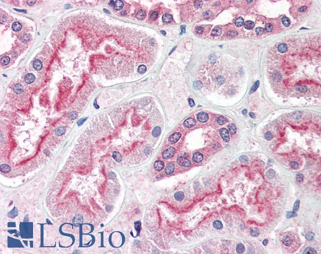Anti-ADAM20 antibody LS-A9787 IHC of human kidney. Immunohistochemistry of formalin-fixed, paraffin-embedded tissue after heat-induced antigen retrieval.