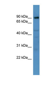ADAM22 antibody LS-C135190 Western blot of Mouse Liver lysate.