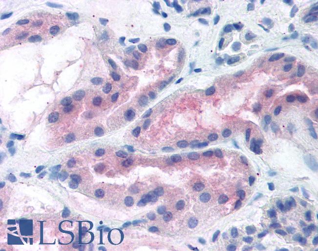 Anti-ABCA7 antibody IHC of human kidney. Immunohistochemistry of formalin-fixed, paraffin-embedded tissue after heat-induced antigen retrieval. Antibody LS-B222 concentration 5 ug/ml.