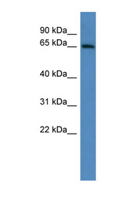 ADAM23 antibody LS-C135189 Western blot of Mouse Heart lysate.