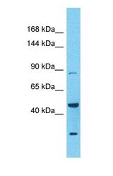 Western blot of ADAM23 Antibody with human PANC1 Whole Cell lysate.