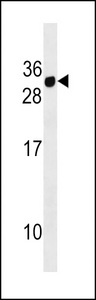 CD300E Antibody western blot of MDA-MB453 cell line lysates (35 ug/lane). The CD300E antibody detected the CD300E protein (arrow).