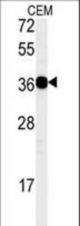 Western blot of CD300LB Antibody in CEM cell line lysates (35 ug/lane). CD300LB (arrow) was detected using the purified antibody.