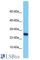 CD300f antibody Western Blot of HepG2. Antibody dilution: 1 ug/ml.
