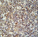 CLM1 Antibody immunohistochemistry of formalin-fixed and paraffin-embedded human lymph tissue followed by peroxidase-conjugated secondary antibody and DAB staining.