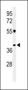 Western blot of CLM1 Antibody in K562 cell line lysates (35 ug/lane). CLM1 (arrow) was detected using the purified antibody.