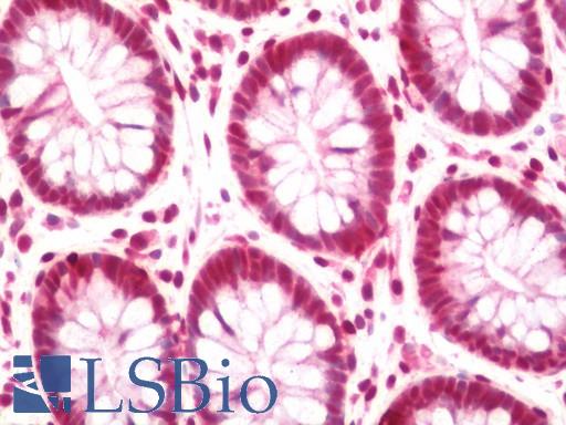 Human Colon: Formalin-Fixed, Paraffin-Embedded (FFPE)