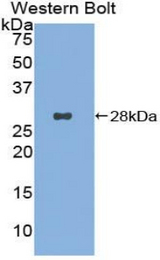 Western blot of recombinant CD302.