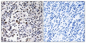 IHC of paraffin-embedded human lymph node tissue, using CD302 Antibody. The picture on the right is treated with the synthesized peptide.