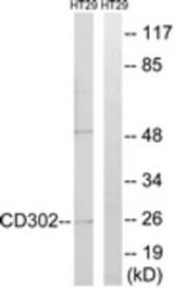 Western blot of extracts from HT-29 cells, using CD302 Antibody. The lane on the right is treated with the synthesized peptide.