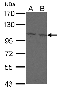 Sample (30 ug of whole cell lysate) A: 293T B: A431 7.5% SDS PAGE FCRL5 / FCRH5 antibody diluted at 1:500