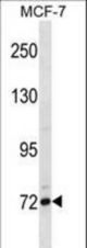 FCRL5 Antibody western blot of MCF-7 cell line lysates (35 ug/lane). The FCRL5 antibody detected the FCRL5 protein (arrow).