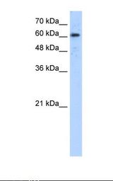 HepG2 cell lysate. Antibody concentration: 5.0 ug/ml. Gel concentration: 12%.