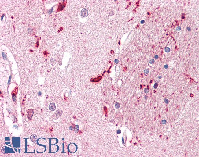 Anti-IGSF8 antibody LS-A9272 IHC of human brain, putamen. Immunohistochemistry of formalin-fixed, paraffin-embedded tissue after heat-induced antigen retrieval.