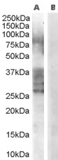 Antibody (0.3 ug/ml) staining of Human Prostate lysate (35 ug protein in RIPA buffer) with (B) and without (A) blocking with the immunizing peptide. Primary incubation was 1 hour. Detected by chemiluminescence.