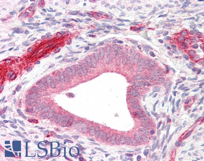 Anti-ADAM33 antibody IHC staining of human uterus. Immunohistochemistry of formalin-fixed, paraffin-embedded tissue after heat-induced antigen retrieval.