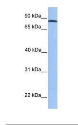 Hela cell lysate. Antibody concentration: 1.0 ug/ml. Gel concentration: 12%.