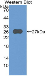 Western blot of recombinant ADAM8.