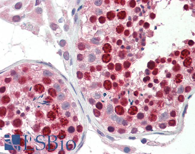 Anti-ABCA9 antibody IHC staining of human testis. Immunohistochemistry of formalin-fixed, paraffin-embedded tissue after heat-induced antigen retrieval. Antibody LS-B10283 concentration 5 ug/ml.