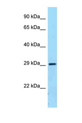 FCGR2B / CD32B antibody LS-C146182 Western blot of Fetal Lung lysate. Antibody concentration 1 ug/ml.