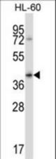 FCGR2B Antibody western blot of HL-60 cell line lysates (35 ug/lane). The FCGR2B antibody detected the FCGR2B protein (arrow).