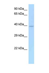 CD33 antibody LS-C146059 Western blot of Fetal Heart lysate. Antibody concentration 1 ug/ml.